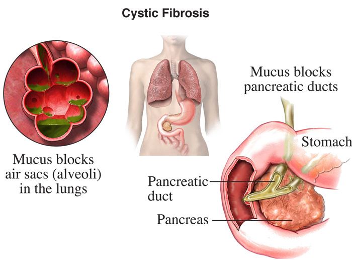 Disease 1